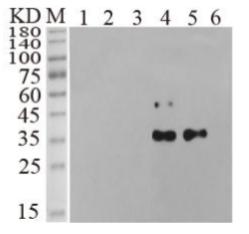 Primary Antibody: Anti-His Antibody, 1:2000
Secondary Antibody: Goat Anti-Mouse, 1:10000
M, Protein marker 1, Cell secretion medium (empty vector) 2, Cell lysis supernatant (empty vector) 3, Cell lysis pellet (empty vector) 4, Cell secretion medium (DOK5) 5, Cell lysis supernatant (DOK5) 6, Cell lysis pellet (DOK5)